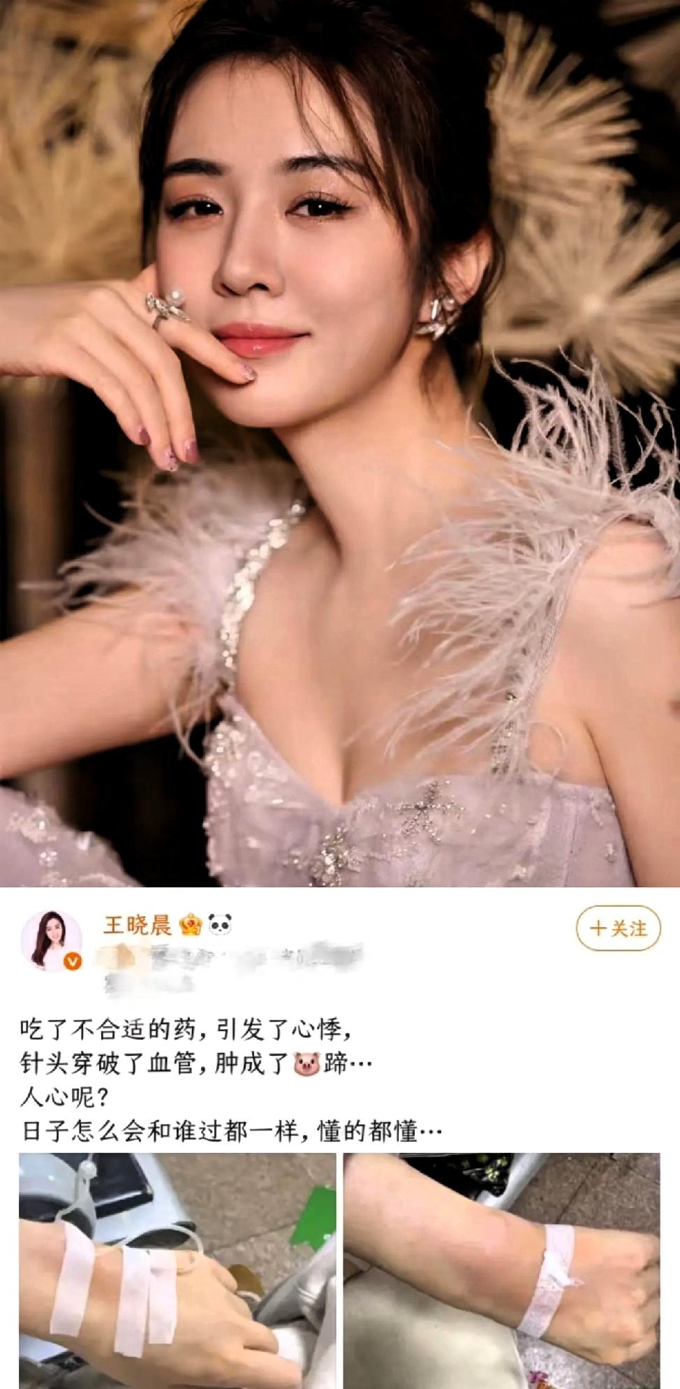 俞灏明现在，估计像吞了苍蝇一样膈应，因为王晓晨分享了自己就医的经历，提及自己吃错