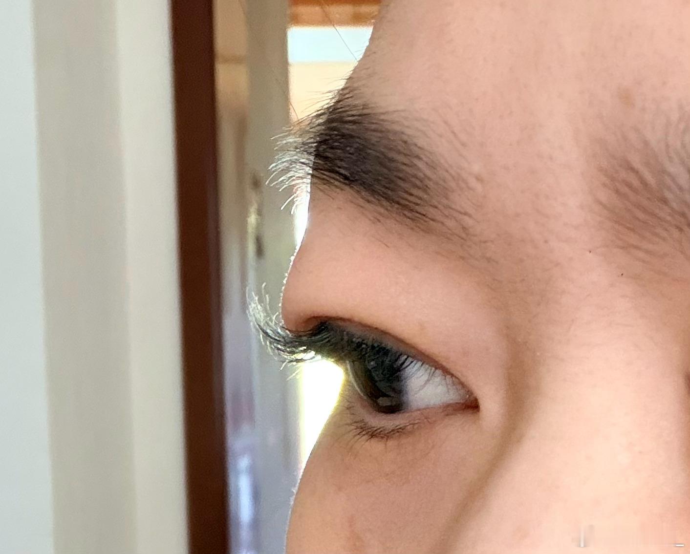 换了个洗面奶，用了一次干过敏了，现在又痒又肿，眼皮都肿的睁不开了，以后再也不乱换