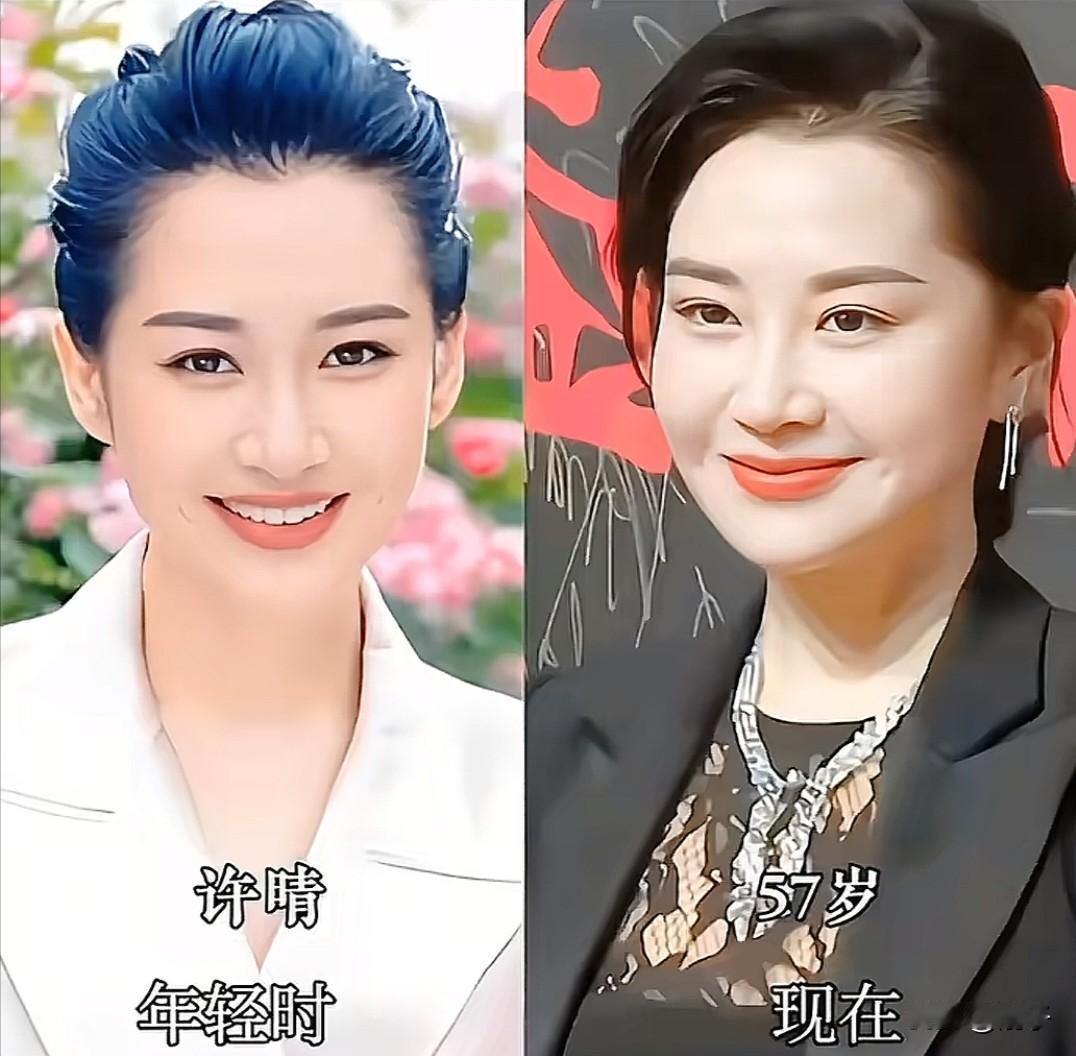 90年代的荧幕上，许晴是多少人心中的白月光。
年轻时的她，穿着白西装，笑起来眼睛
