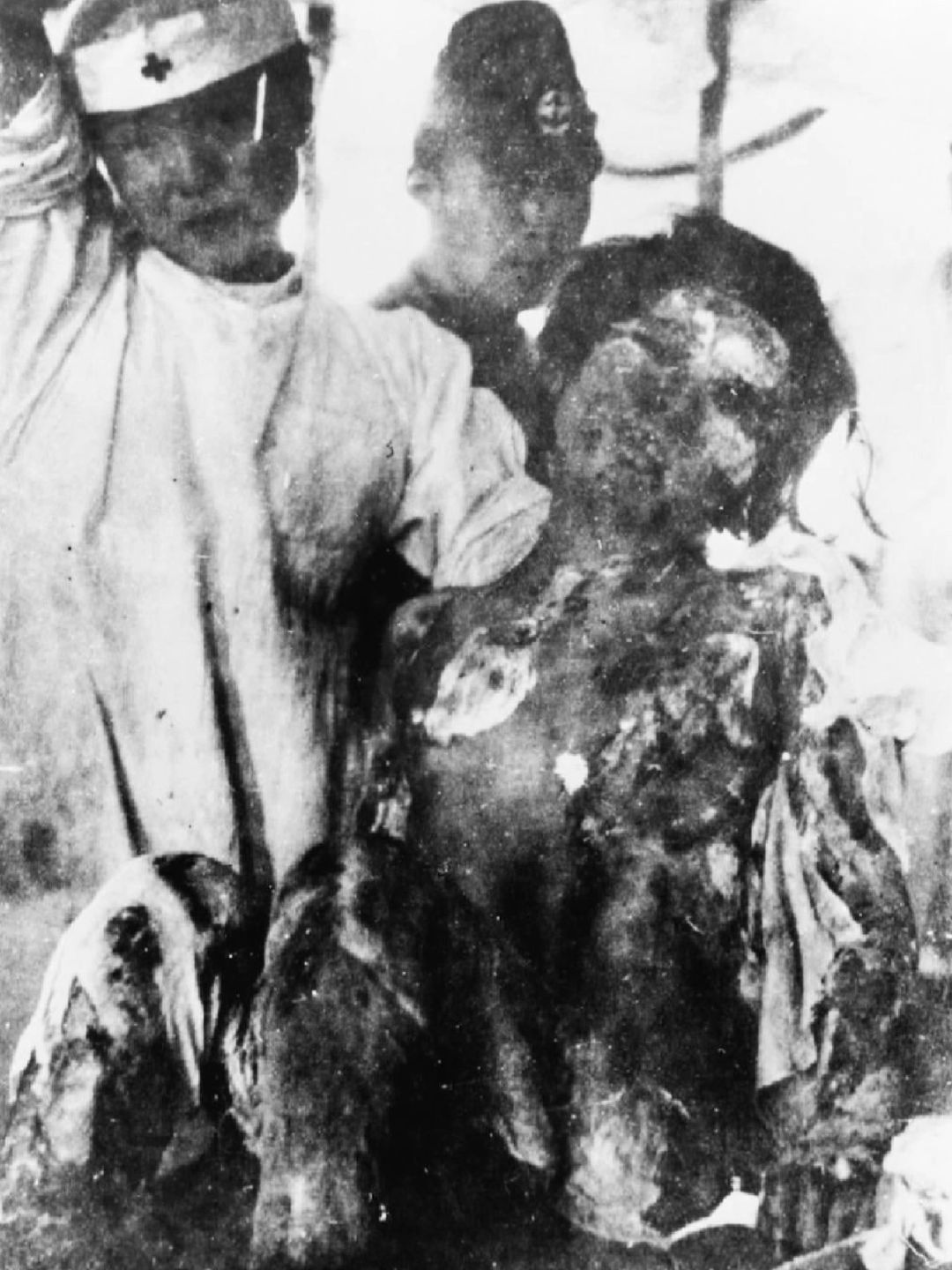 原子弹爆炸幸存者｜1945年
