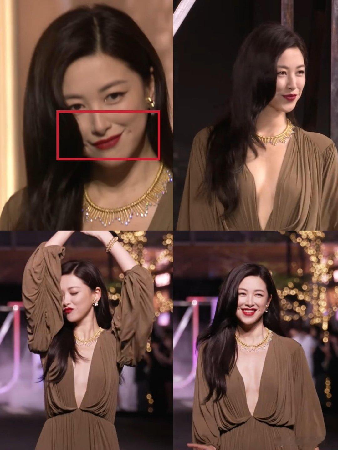 不是….只有我发现了吗？法令纹一定就是老的表现吗？ ​​​
