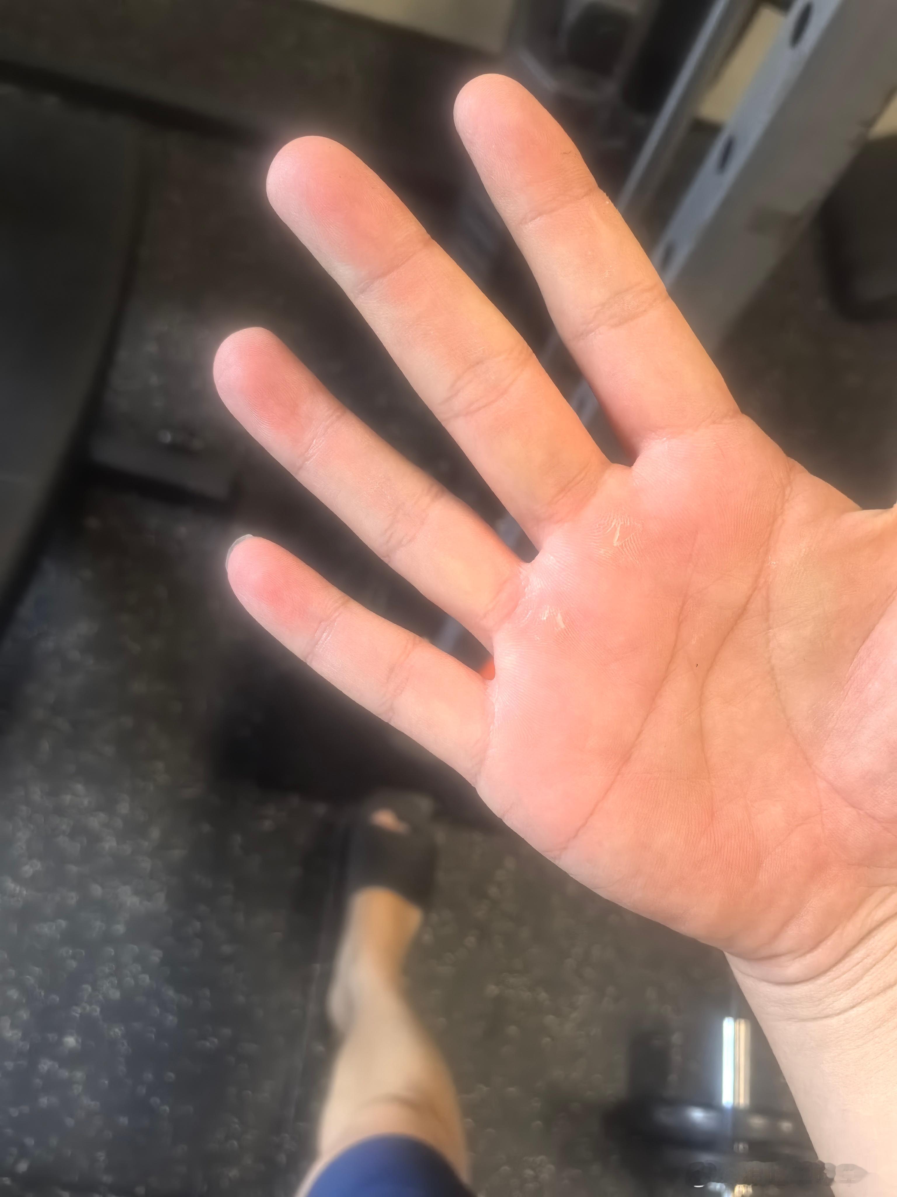 所以，“你的仇敌若饿了，就给他吃；若渴了，就给他喝。因为你这样行，就是把炭火堆在