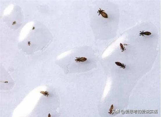 为啥改革开放前，人们身上普遍长虱子？
 
改革开放前很多人身上、头上长虱子，核心