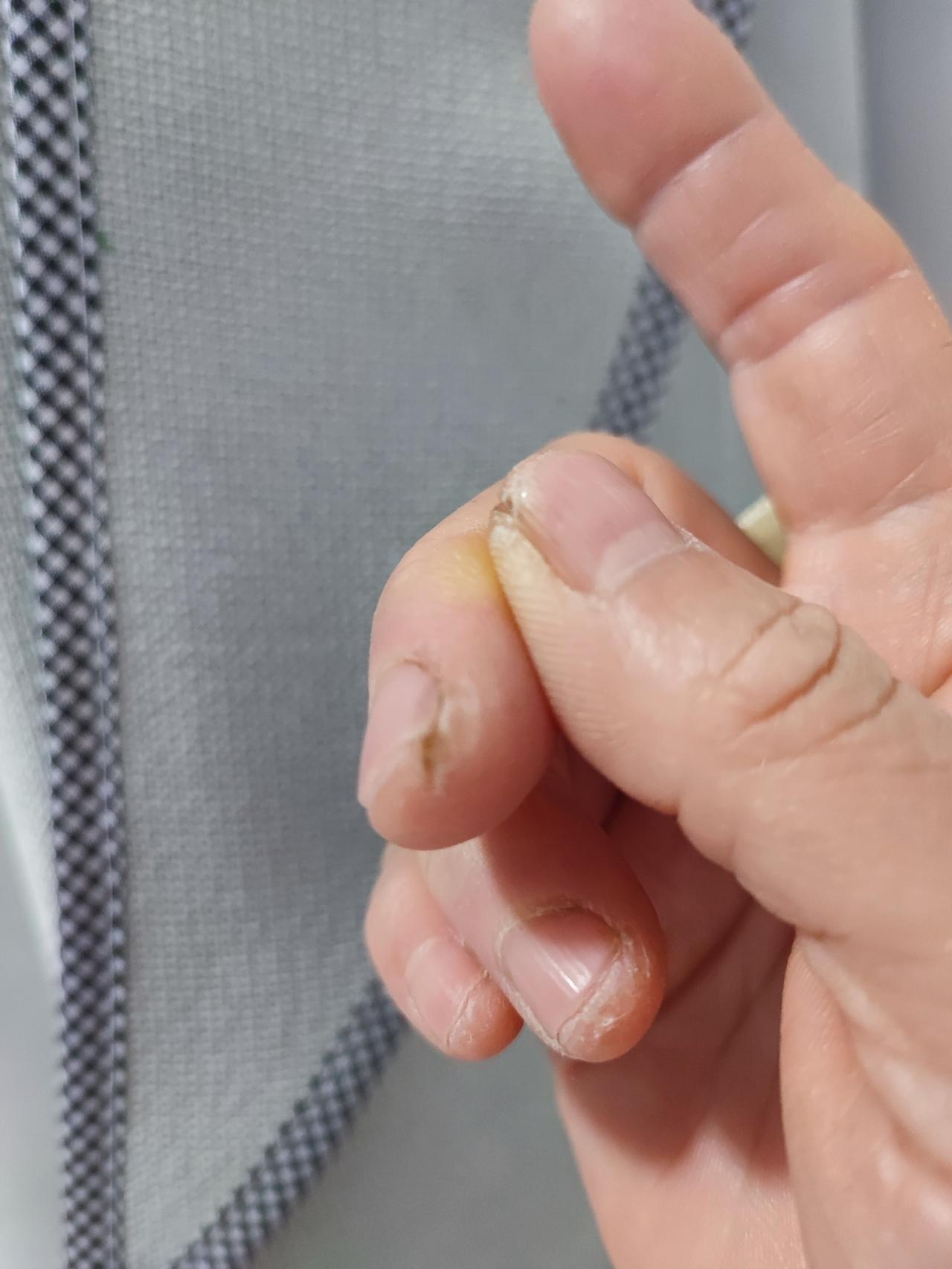 这是病还是缺东西啊！[黑线]
也没种过地，
也没干过啥活，
一辈子就是做饭、搞搞