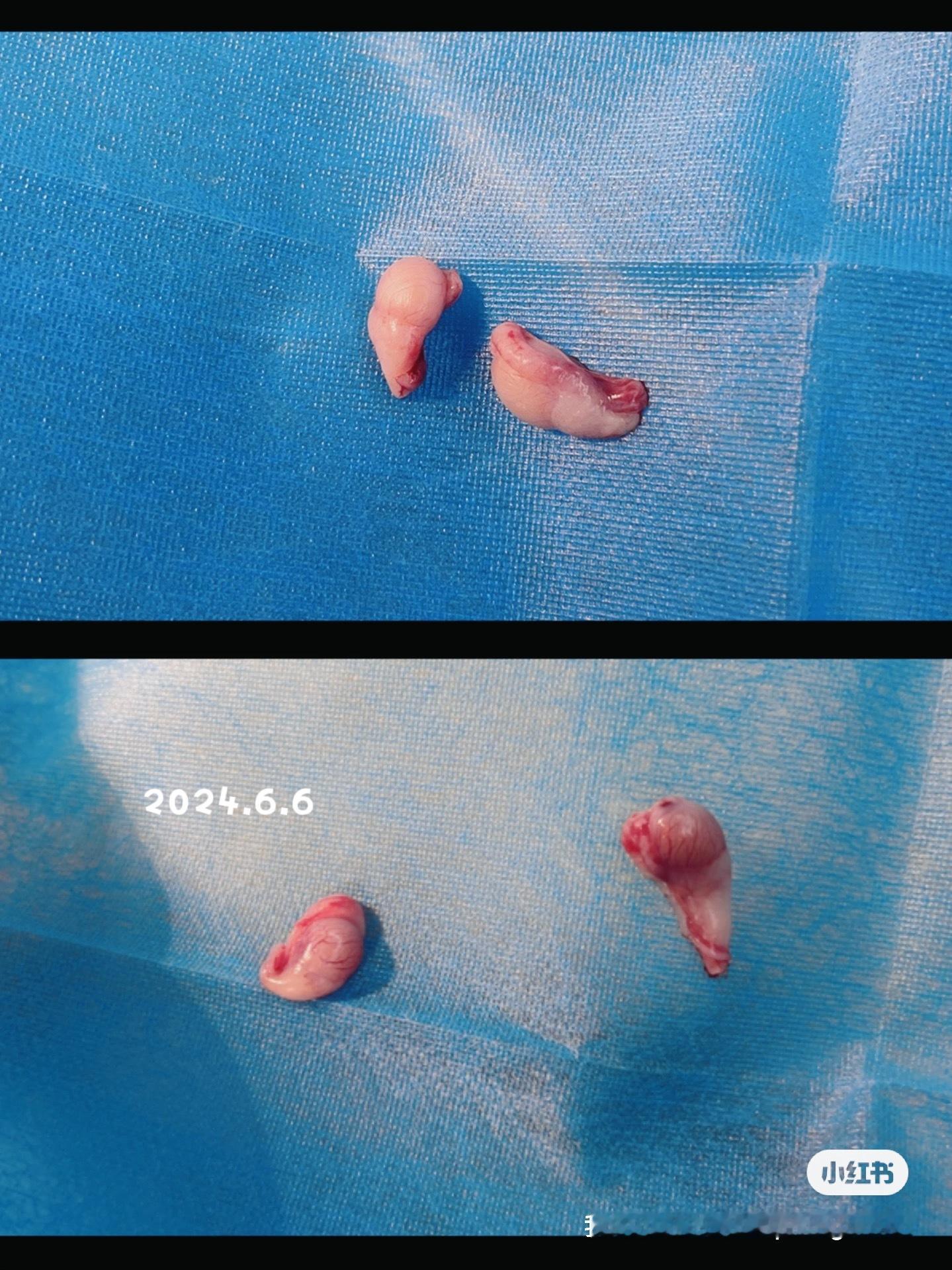 四小只窝次顺利绝育啦恢复好就可以奔赴新家咯#金点色##金点##英国长毛猫##金渐