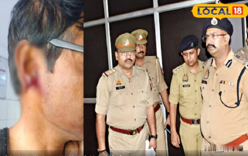 ### 够狠！丈夫耳朵被妻子咬掉、嚼碎、吞下### ——印度北方邦阿格拉，警察接