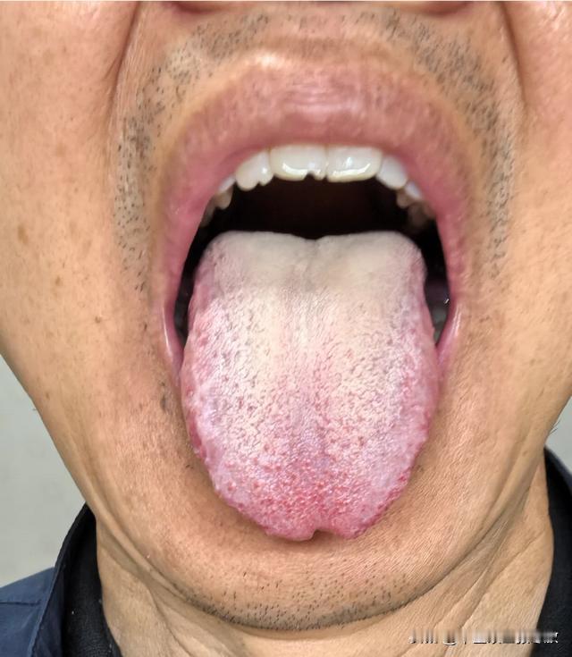 说了一遍又一遍，你啊，就是一点不听，自以为是[黑线][黑线][黑线]
男科不行，