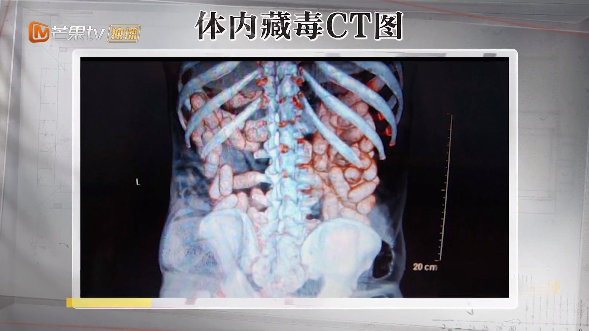 人体藏毒有多恐怖？via.​​​