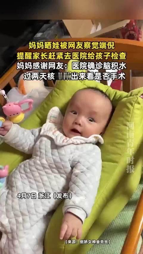 宝妈晒娃被全网"逼"就医，确诊脑积水！一场刷屏的善意，救了一个家

谁能想到，一