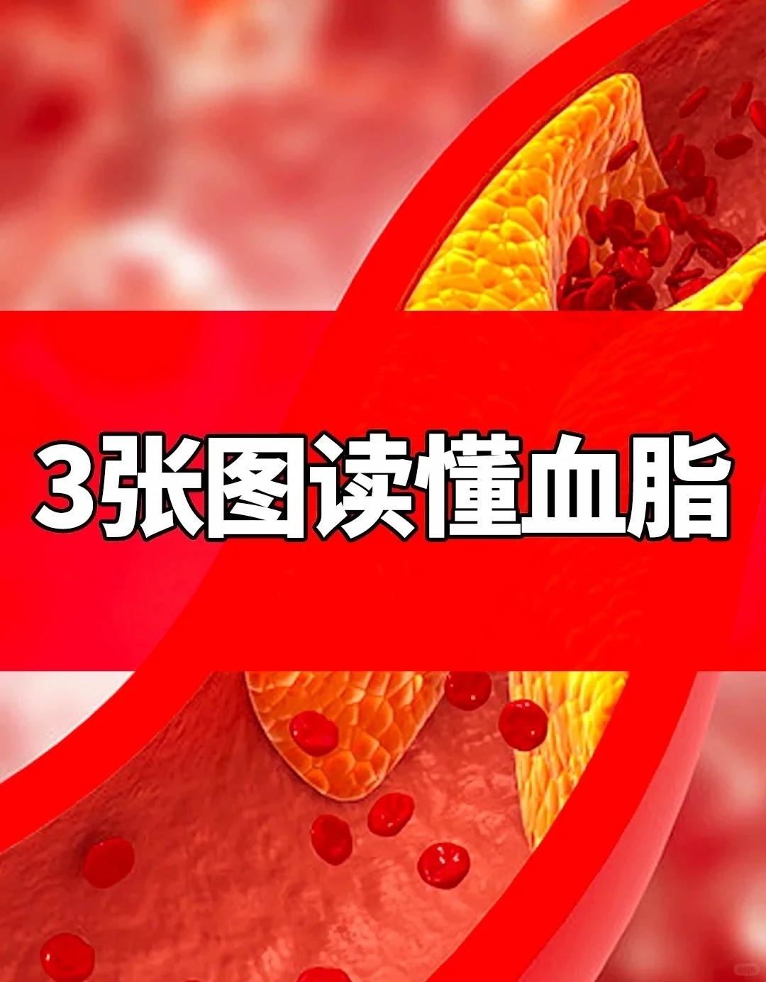 高血脂的危害。