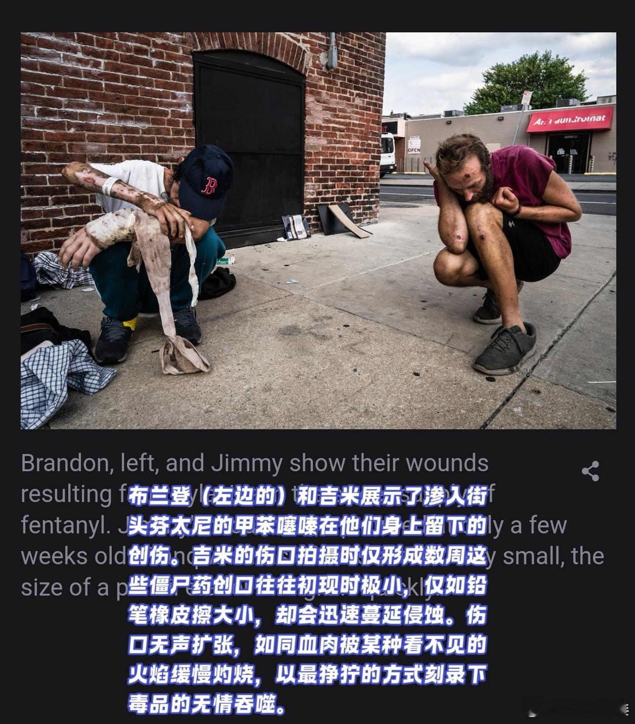 国外流浪者脚腐烂反被网络嘲笑人文摄影 这几天看了一些美国的街头摄影作品，发现很多