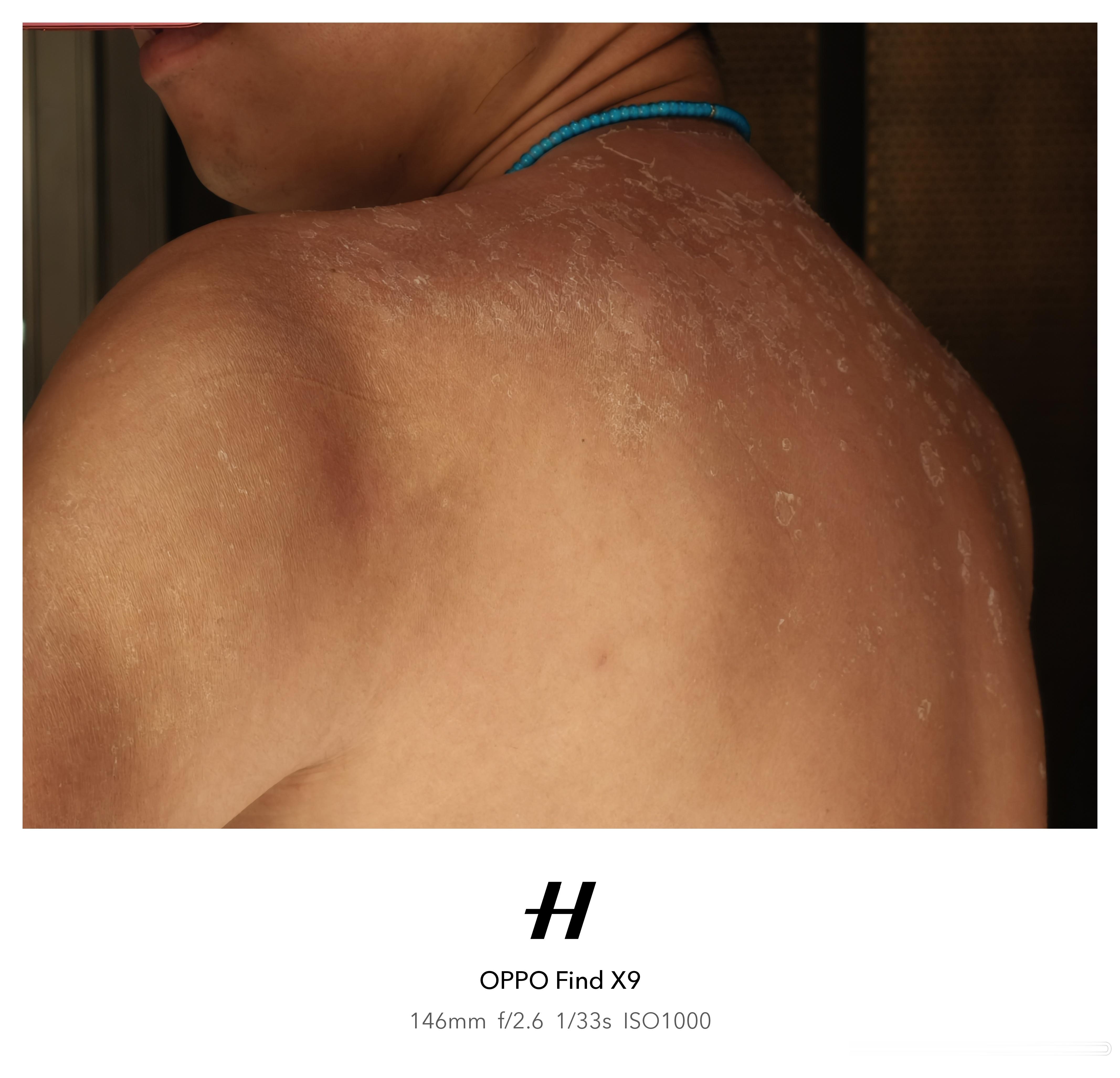 暴晒之后该蜕变了 深圳