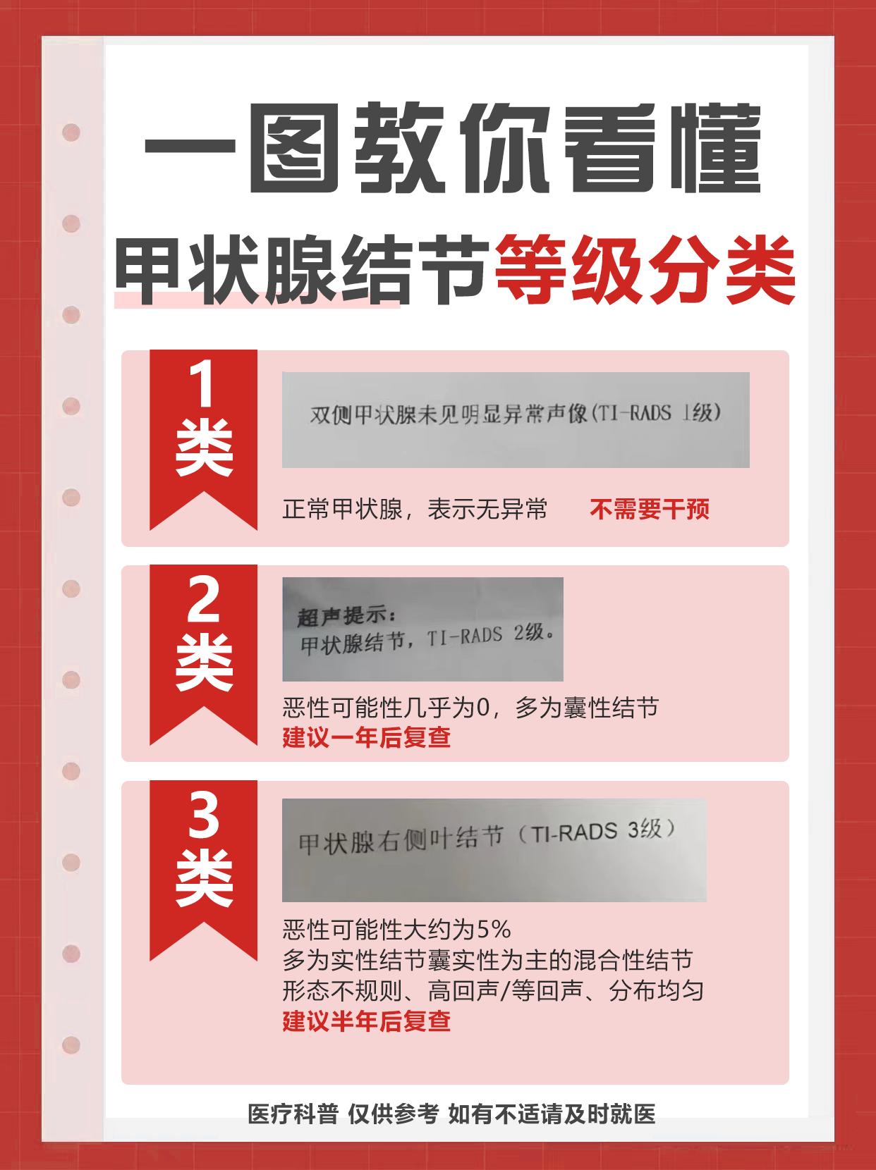 甲状腺结节等级分类，看看你是哪一类！
😜宝子们，今天来给大家讲讲甲状腺结节的分