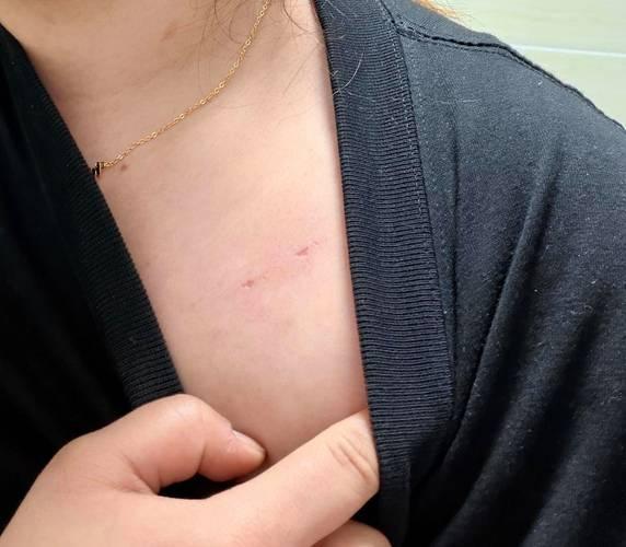 女子在家洗澡时遭醉酒男子闯入，涉事男子因非法侵入住宅、猥亵被依法采取刑事强制措施