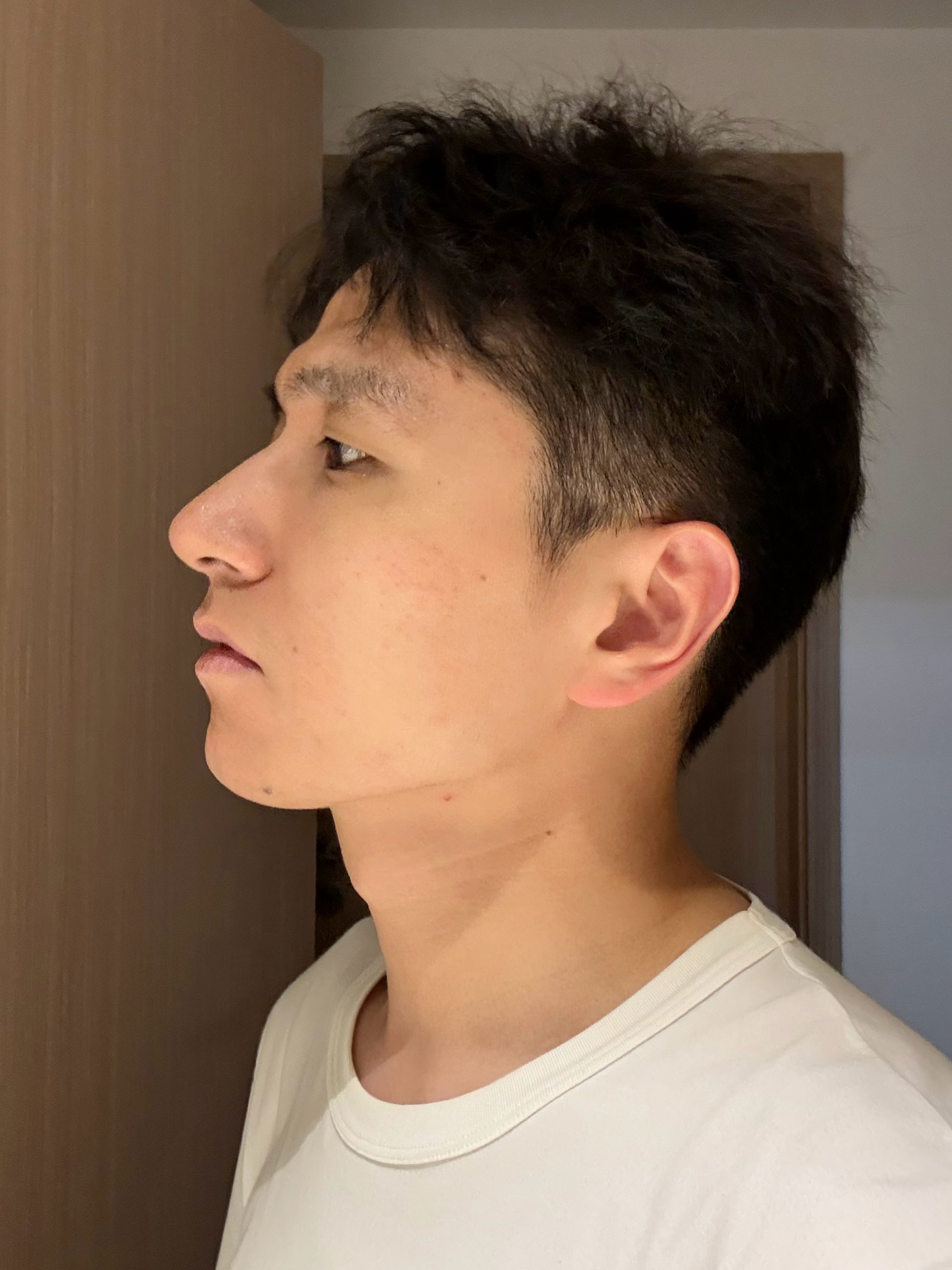 眉毛越来越淡了，强光下更明显