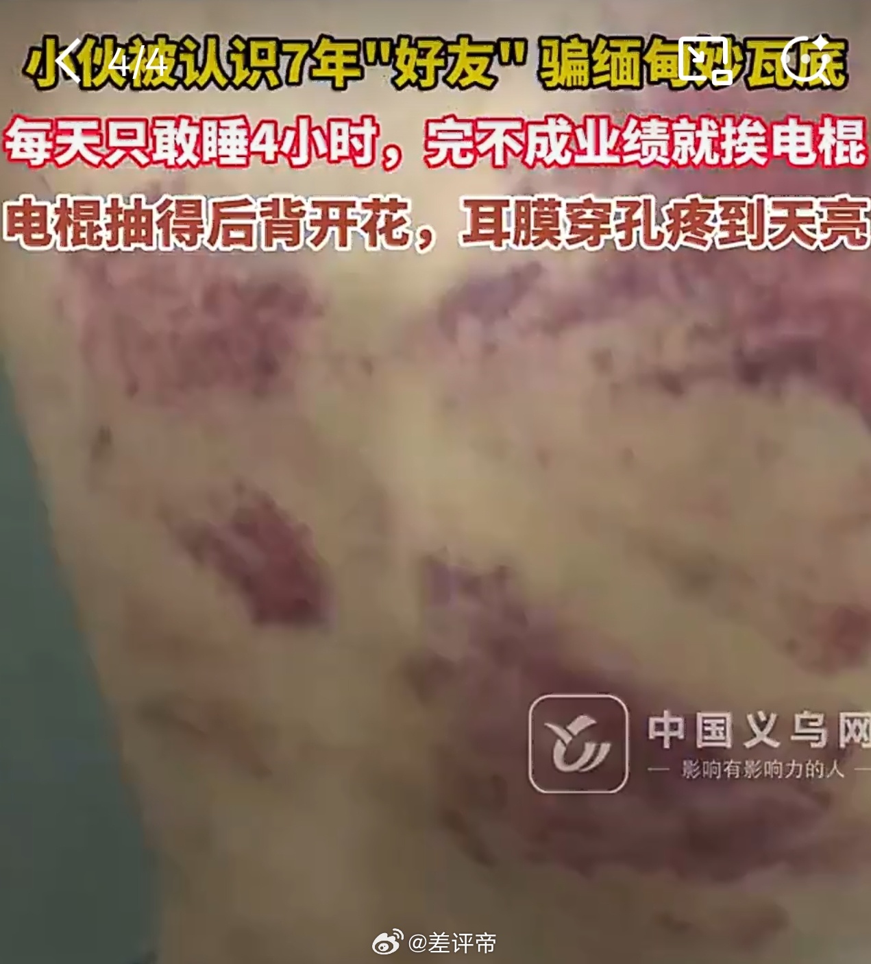 电诈园区打人皮开肉绽再浇辣椒水打他皮开肉绽，再浇辣椒水？他们把人当人吗？这个园区