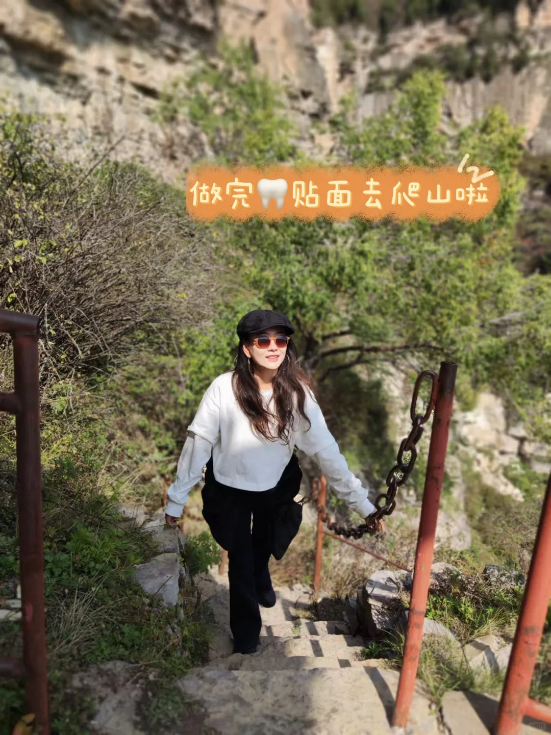 北京牙贴面满月了，我来说一下