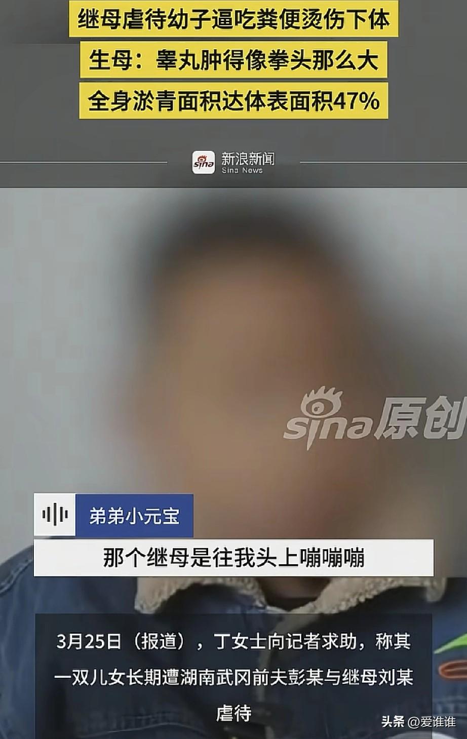 “太残忍了！”姐弟俩遭到继母，亲生父亲长期虐待，用70度热水烫下体，逼着孩子吃大