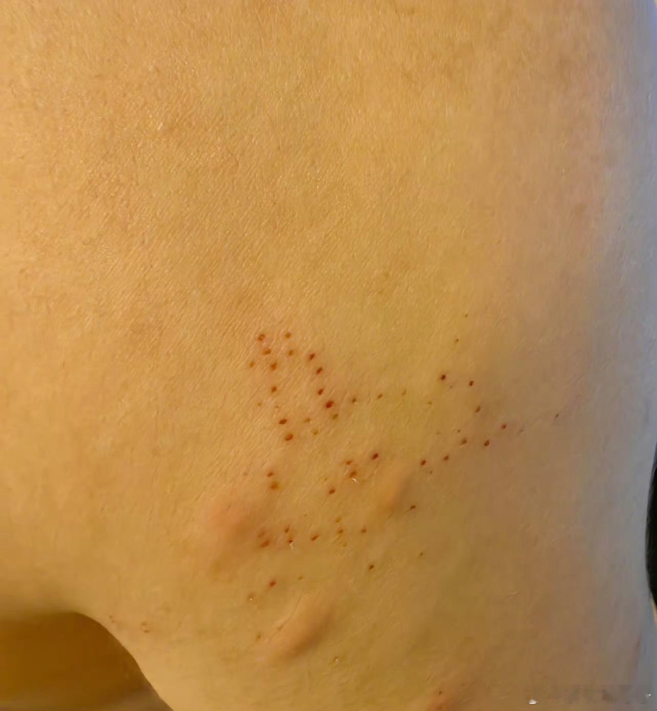 蟑螂咬人 蟑螂，个人感觉是最恶心的生物之一，关键，人类还没找到对付和。它的办法。
