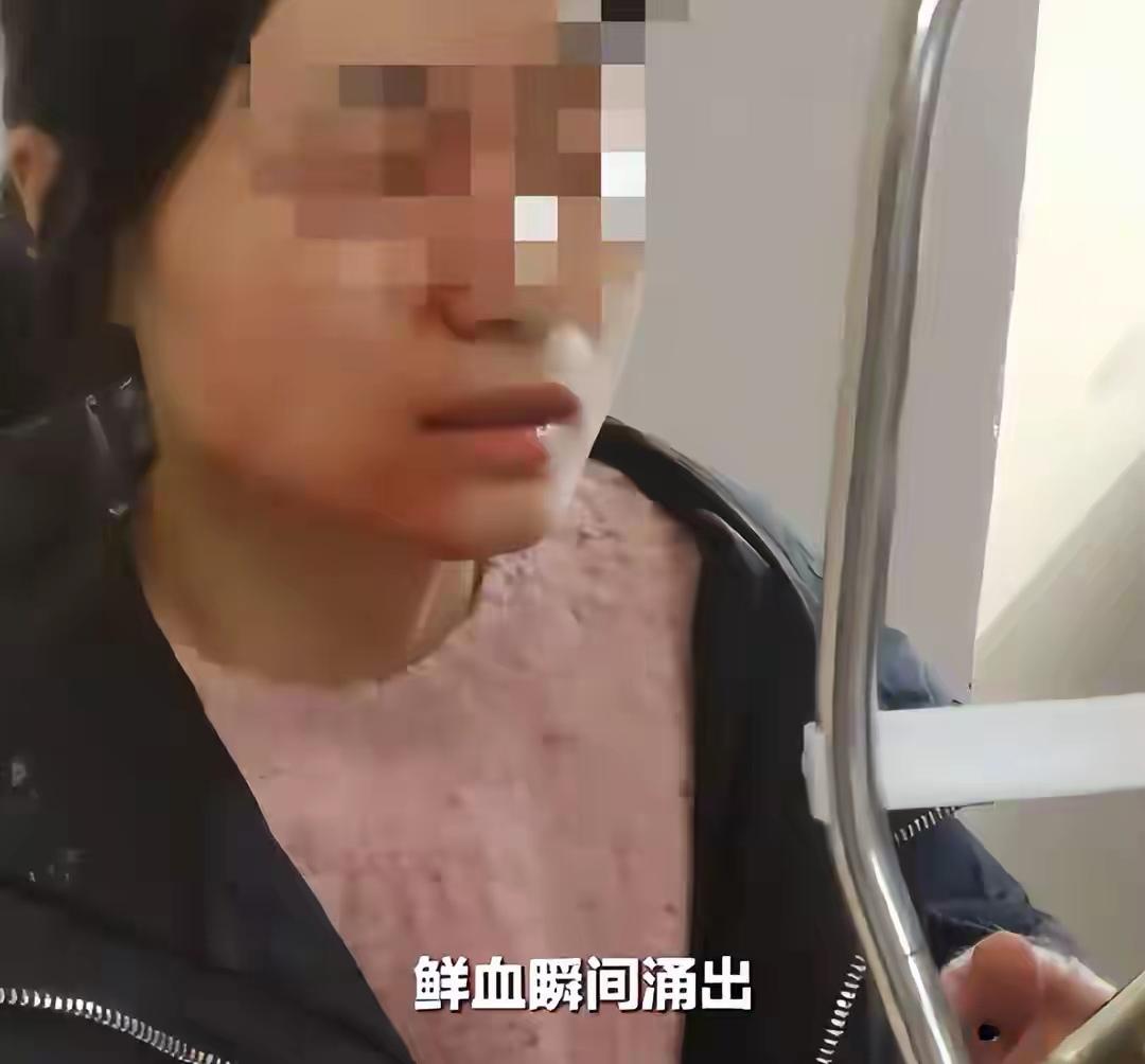 浙江瑞安女教师课堂上制止学生冲突，反被涉事学生用镊子戳伤右眼——虹膜根部离断、晶