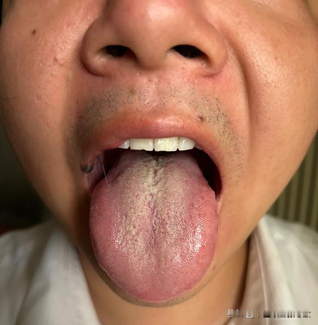 时间又短，状态又差，你这舌头真是要啥没啥[吃瓜群众][吃瓜群众][吃瓜群众]

