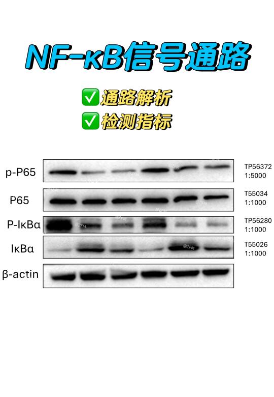 信号通路中需要检测哪些分子❓（以NF-ΚB为例）