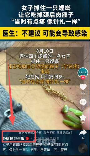 四川成都，一女子脖子上长了个肉瘊子，觉得去医院又贵又麻烦，竟然逮住一只带翅膀的绿