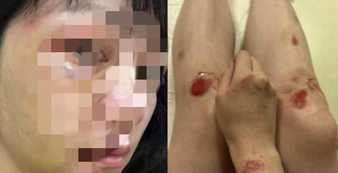 福建厦门，女子常年被丈夫家暴，被打的受不了就离家出走了，多年一直在外地漂泊流浪。