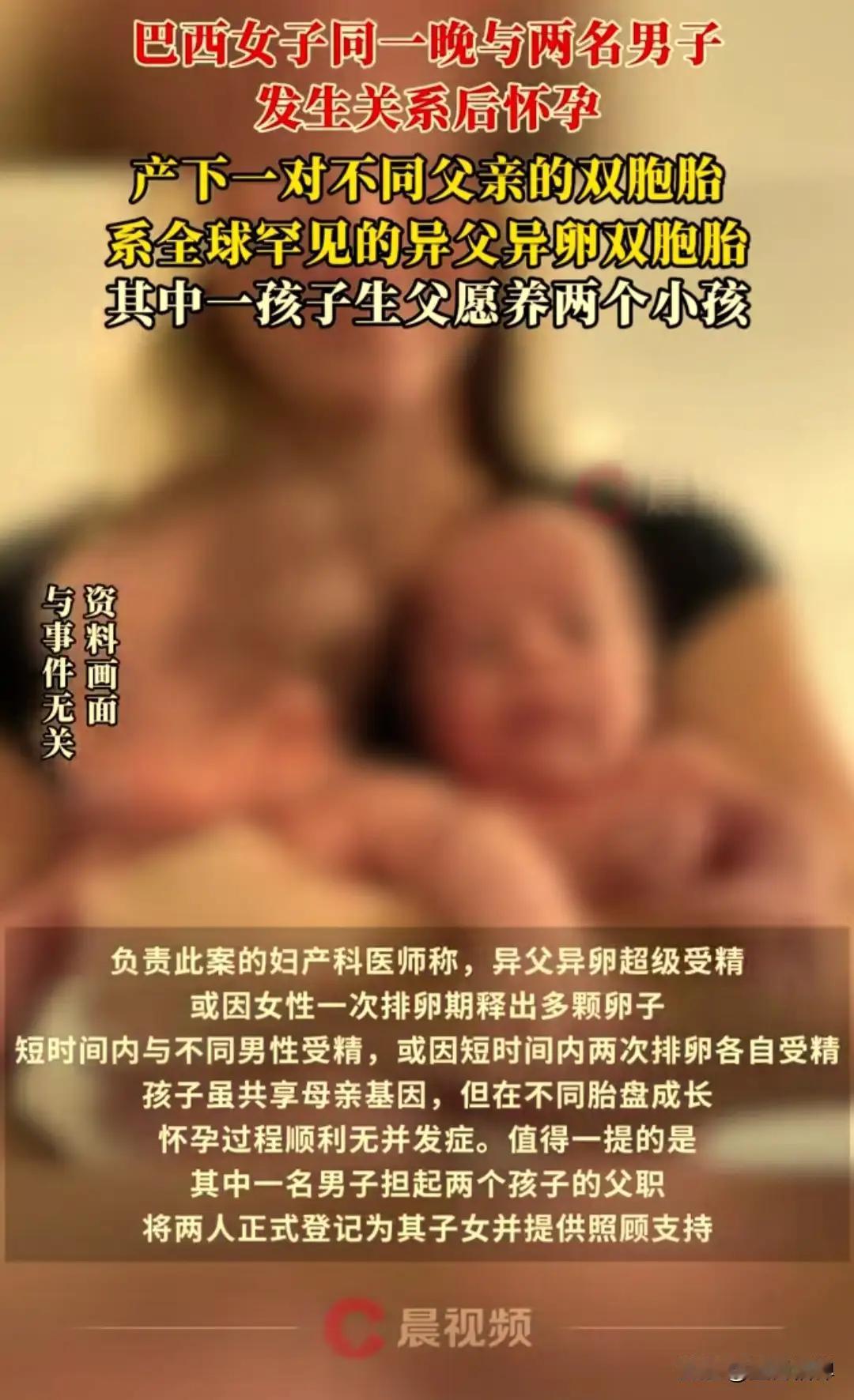 全球仅20例！巴西女子生双胞胎，亲子鉴定查出俩爹？
 （个人观点仅供参考，无任何