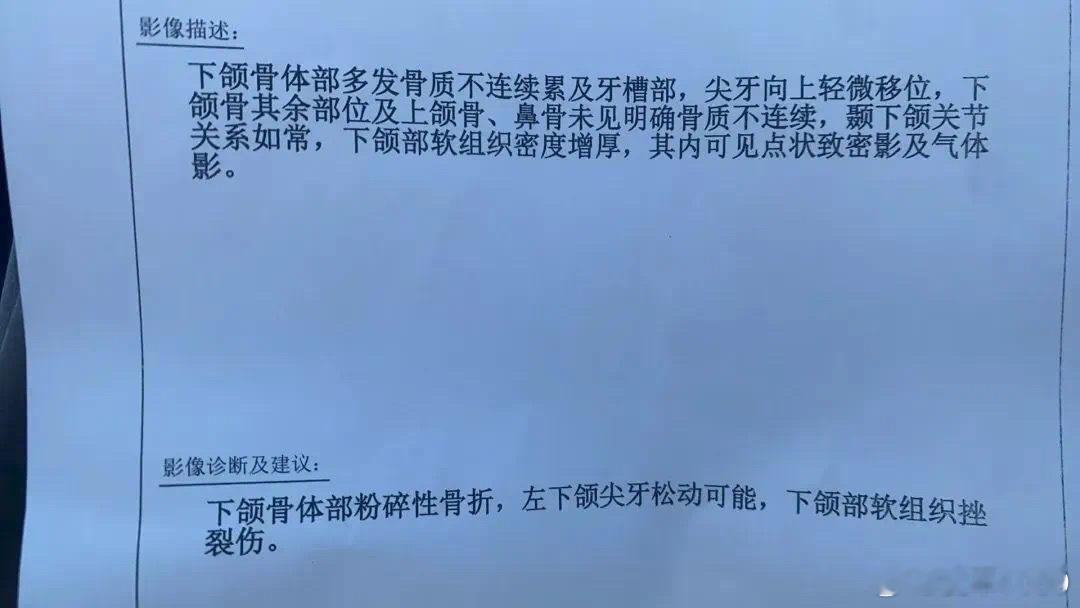 【爱车安全贴士 只能自认倒霉？北京一车主称开车遭飞来石头砸脸致毁容，交警：已立案