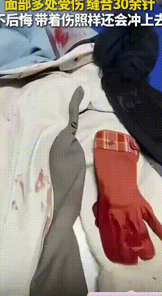 最美“伤疤警花”！休假遇凶徒，她徒手夺刀诠释责任与荣耀
 休假逛街也能遇上惊险事