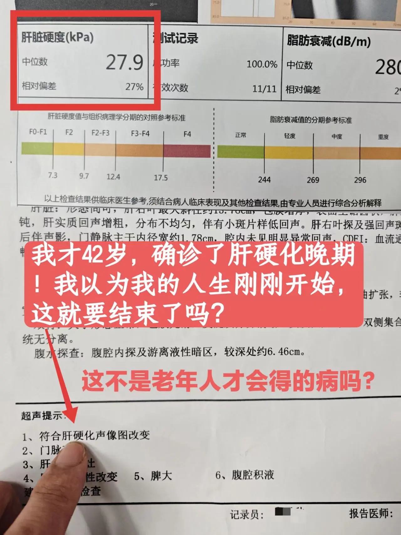 上午拿到了检查结果，昨天晚上失眠了一整晚，虽然已经做好了心理准备，但还...