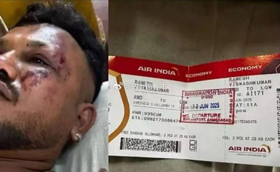 242人中唯一幸存者：空难半年后，他的伤痛远未结束 2025年6月12日，印度航