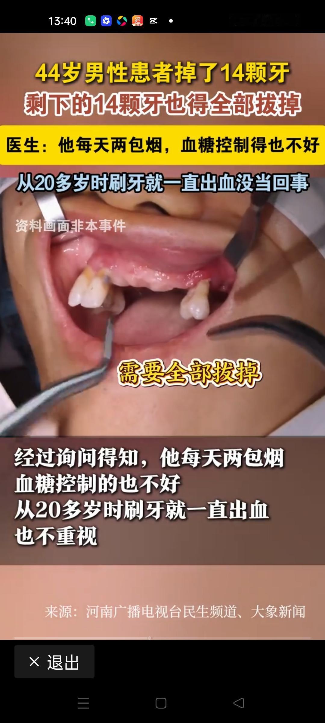 满口牙保不住，不是牙疼，是你在拿命换烟抽
 
44岁，本该是身强体健、撑起家庭的