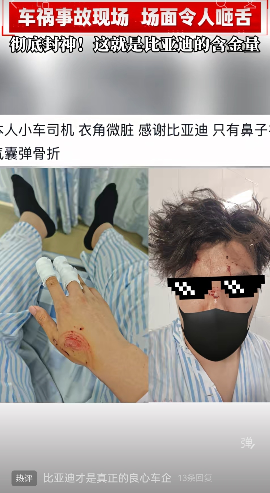 惨烈车祸现场，最大的伤害，是被气囊弹伤了鼻子，比亚迪真的硬！ 