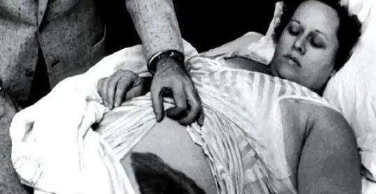 1954年，国外一女子正在睡觉中，突然感觉腹部和大腿被什么东西蹭着了一样，疼痛难