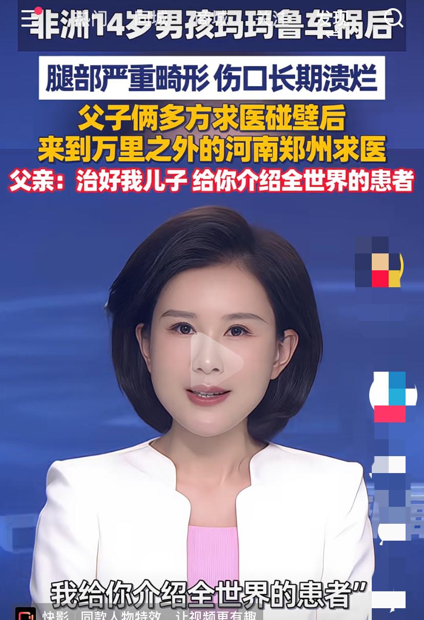 非洲男孩家人要把全世界的患者介绍给郑州医院
    一名14岁的非洲男孩玛鲁因为