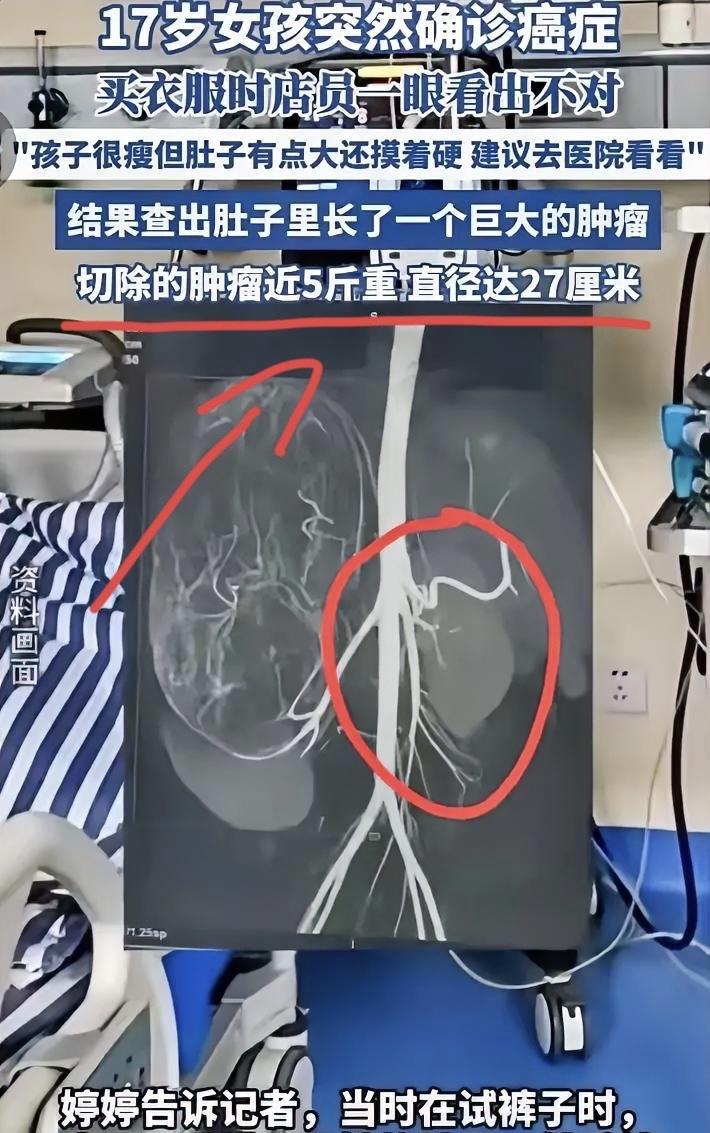 “幸亏发现了！”广东17岁女孩和妈妈一起逛街买衣服，在试裤子的时候，老板娘发觉女