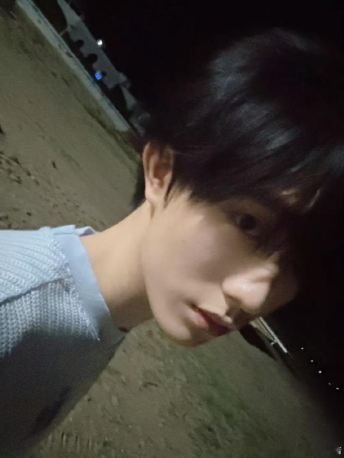 #苏新皓 蚊子包#苏新皓的性格好幽默哦，他展示脸上的蚊子包既逗趣又让人感到怜爱，