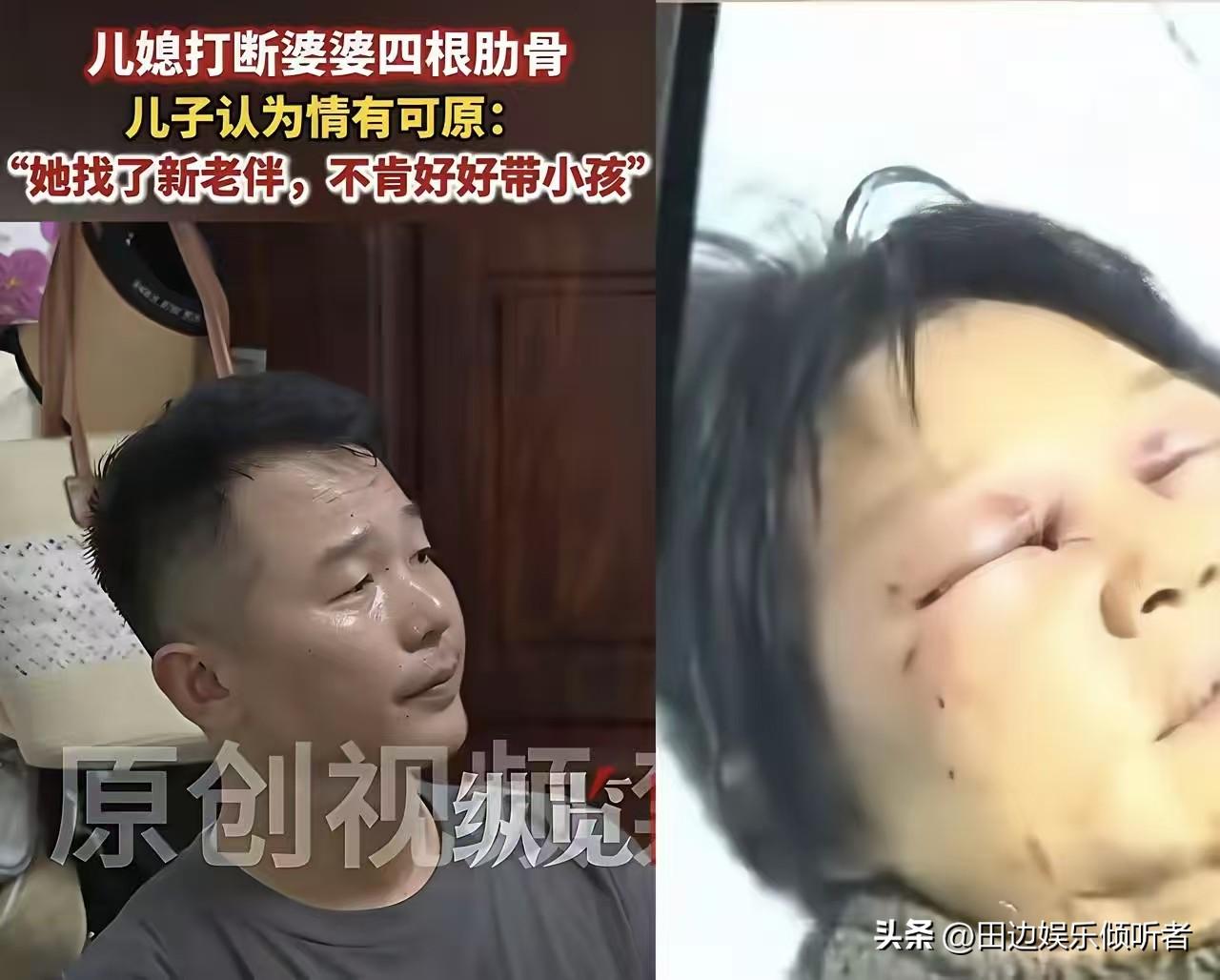 浙江嘉兴婆婆被打这事，

比恶媳更寒心的，

是全程无动于衷的儿子！

只因一句