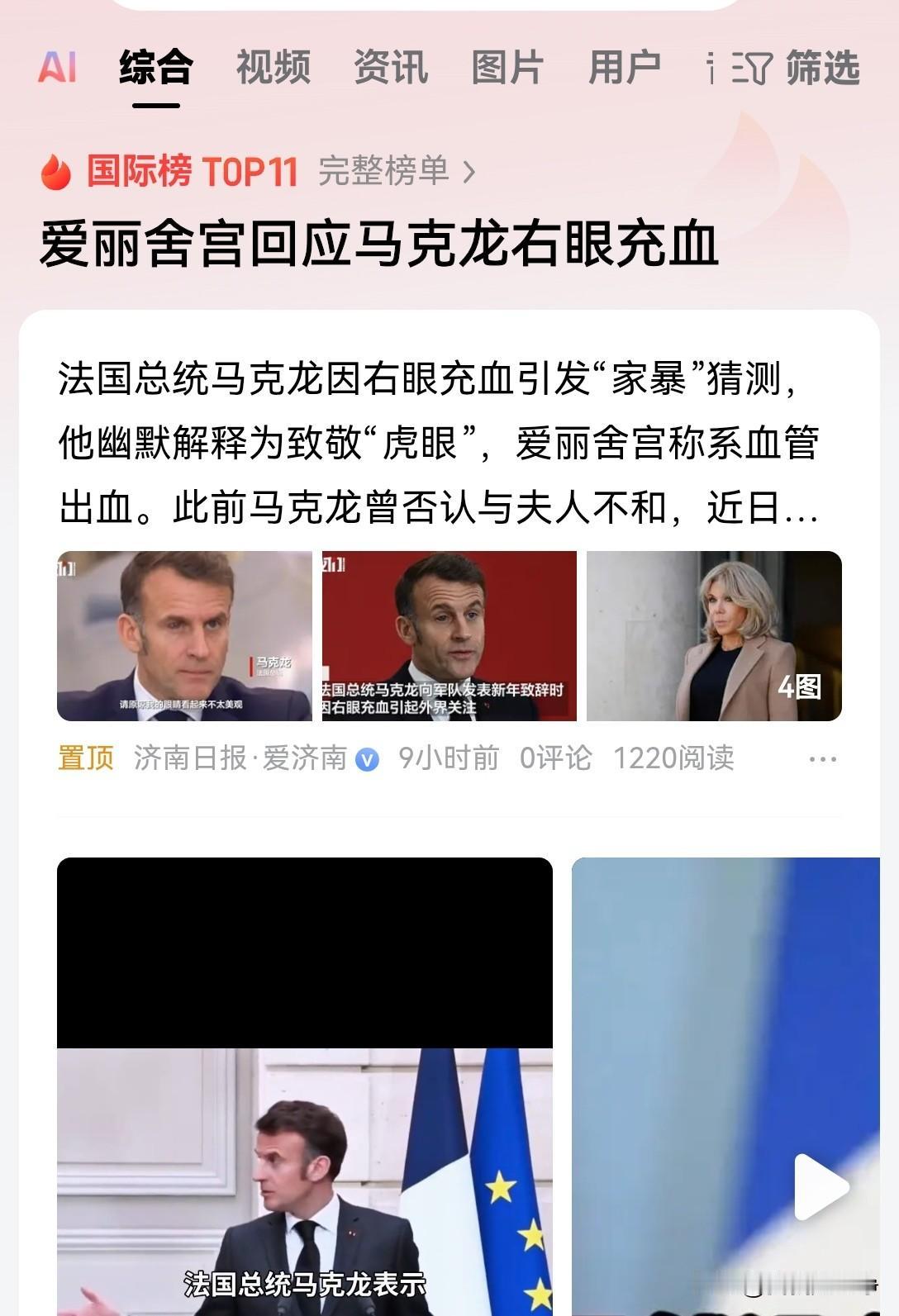 小马哥当个法国总统也不容易啊，大过年的，发表一个新年致辞。
结果右眼充血，就好像