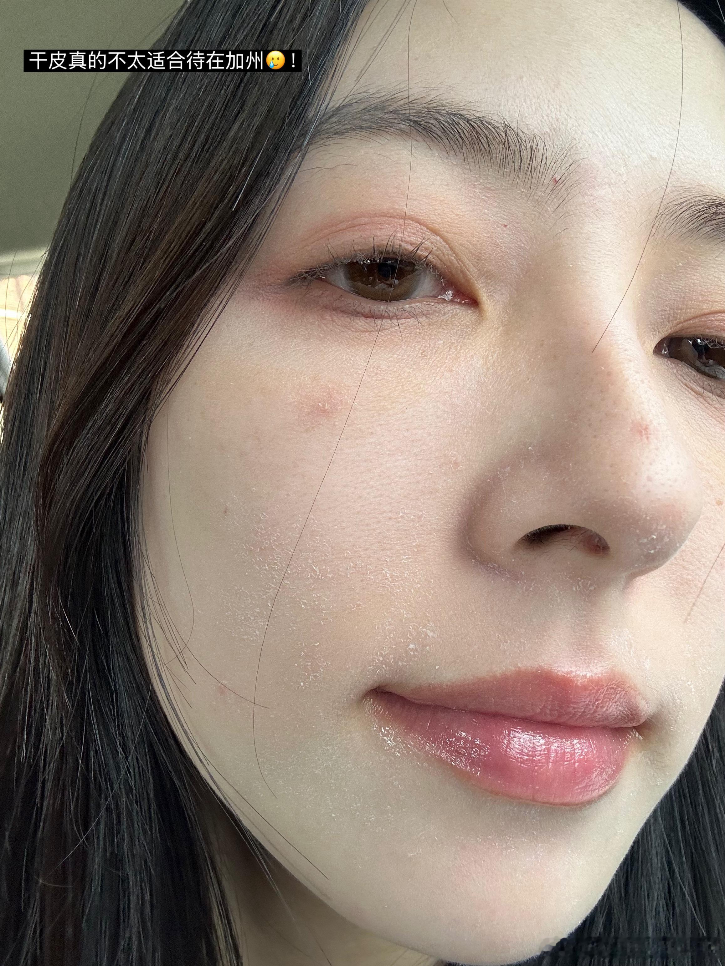 翻翻手机里瞎拍的小日常看着我的脸实在是有点归心似箭了[苦涩] ​​​