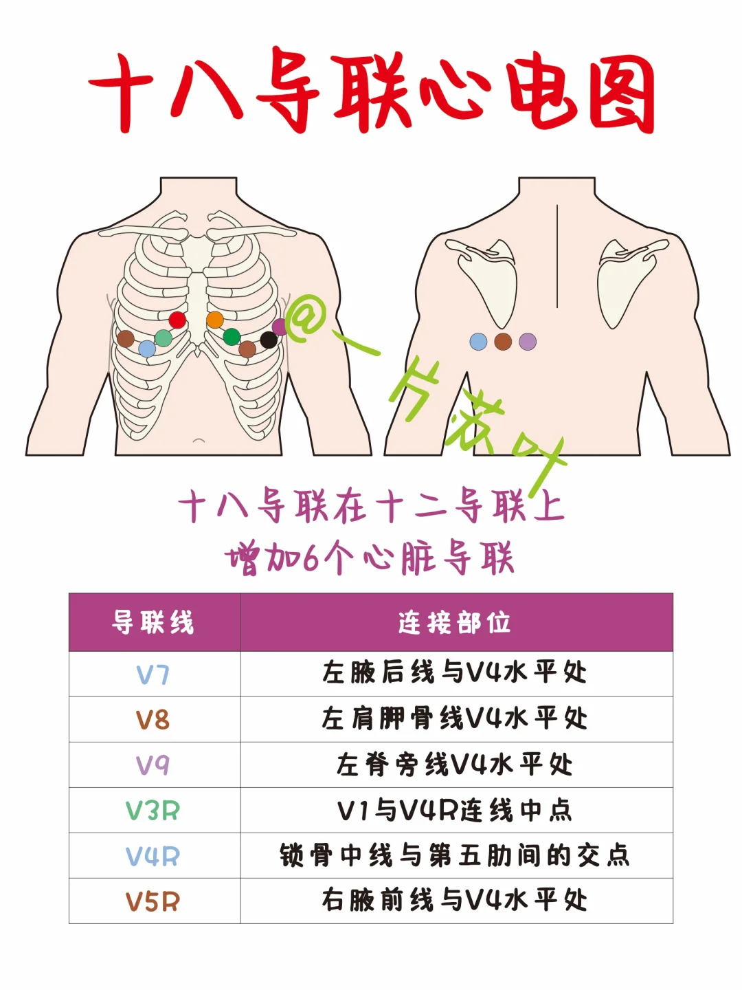 护士笔记✅心电图导联笔记合集📒