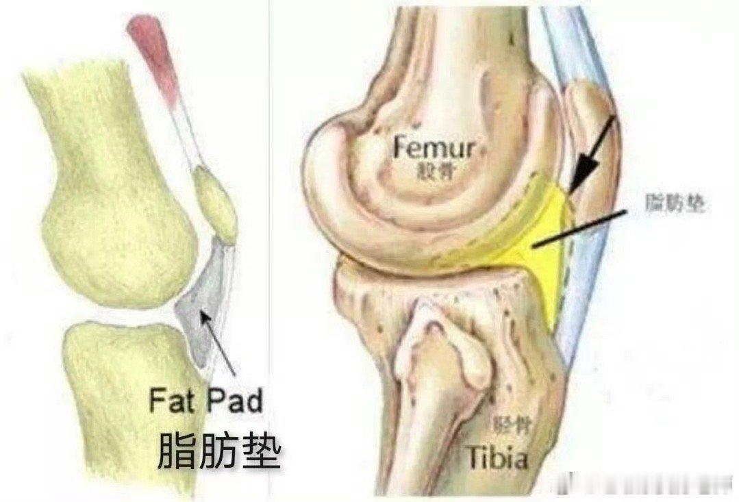 #前叉术后# 很多做了前叉手术的朋友在术后早期走路时可能会一瘸一拐，时间长了，膝