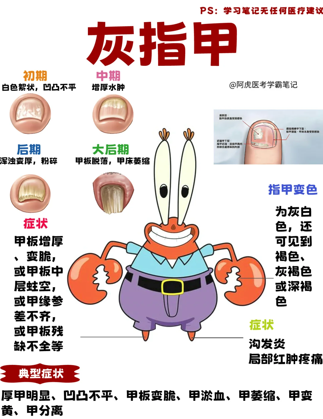医学生笔记📒：灰指甲该怎么治？👆