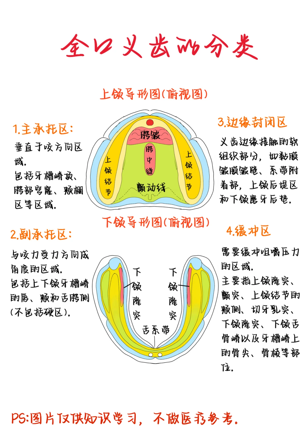 医学生笔记——全口义齿分类
