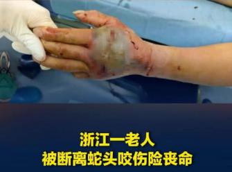被砍下来的蛇头，远比活着的蛇更危险！一名72岁大爷户外偶遇一条剧毒眼镜蛇，深知这