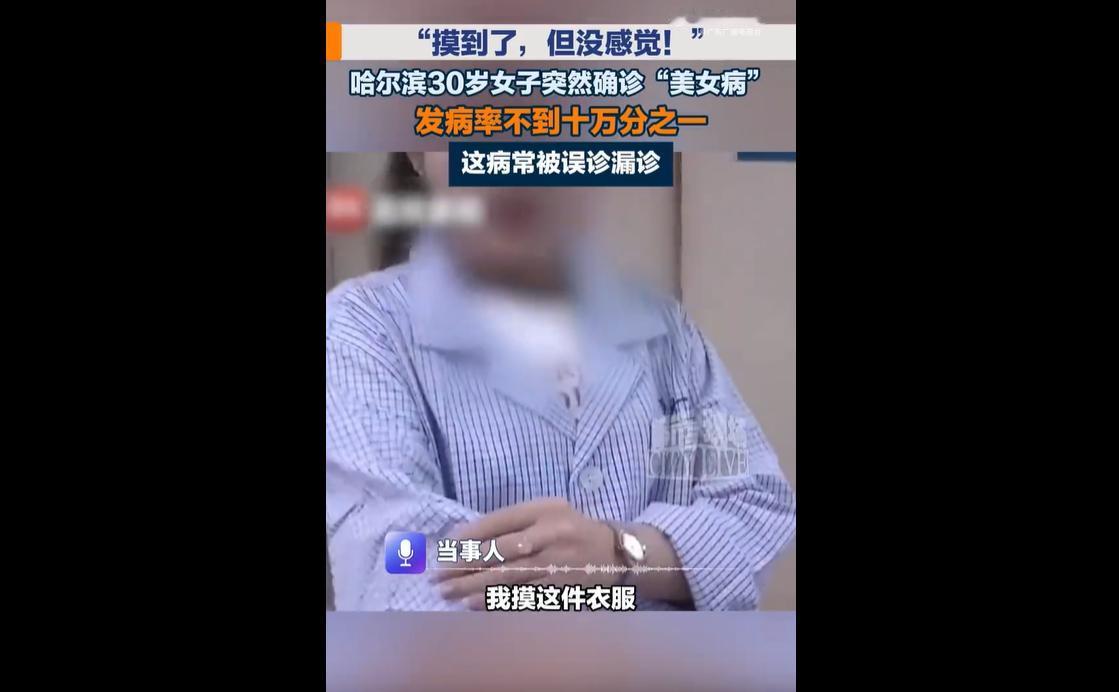 美女病是什么病？
近日，哈尔滨一名三十多岁女子被异常身体症状困扰两年多，手部触感