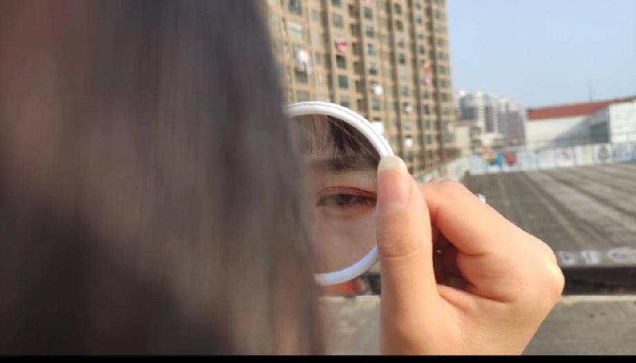 眼睛手术后眼皮一直是有一点肿，眼睫毛在里面露不出来。
        双眼皮现在