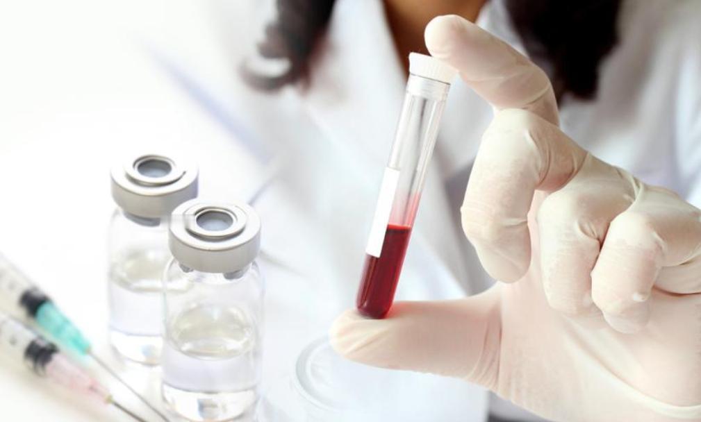 体检报告出现这3个指标异常，当心脑梗心梗！及时干预别忽视

体检报告拿到手，大部